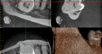 Mon 9 Jan ’17: CBCT Software Tutorial