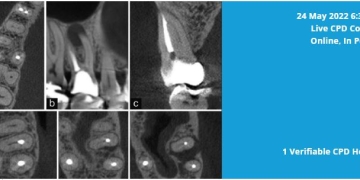 Learn About 3D Imaging and Endodontics