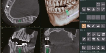 CBCT Level 2 Course for Referrers