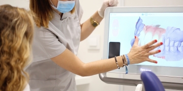 Exploring the Advantages of Dental Intra-Oral Scanning