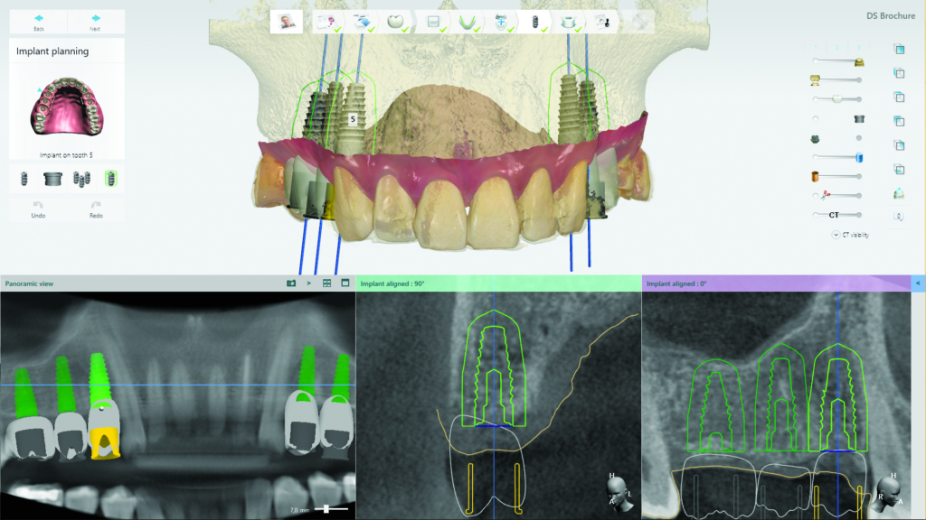 Guided Surgery for Dental Nurses Cavendish Imaging