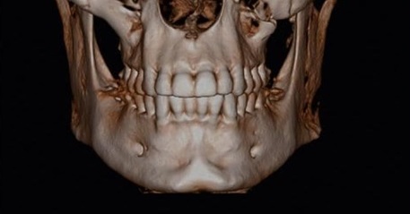 Understanding Normal Anatomy on Dental CBCT: A Practical Guide for ...