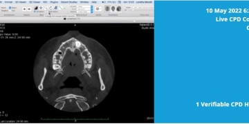 Register for CBCT Software for Apple Mac Course