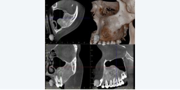 Case Study: Unusual Bone Lesion