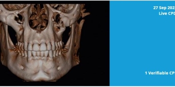 Learn How to Recognise Normal Anatomy on CBCT