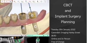 CBCT and Implant Surgery Planning