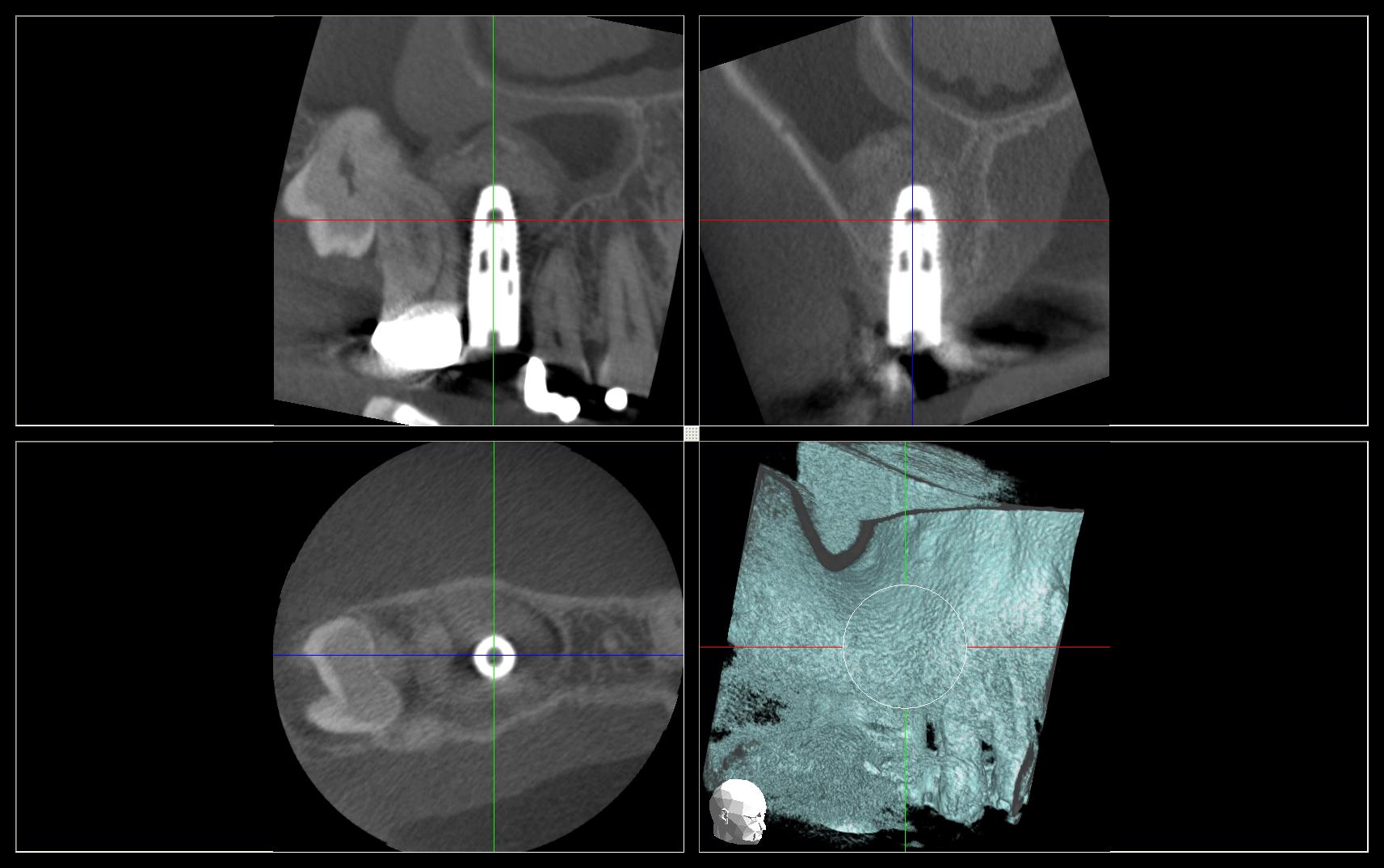 CBCT for Dentistry Dental Scanning Cavendish Imaging