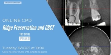 Ridge Preservation and CBCT