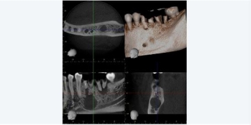 Case Study: Interesting Small Volume CBCT